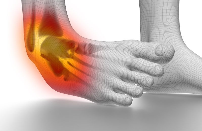 Lật cổ chân thường xảy ra phổ biến trong các môn thể thao
